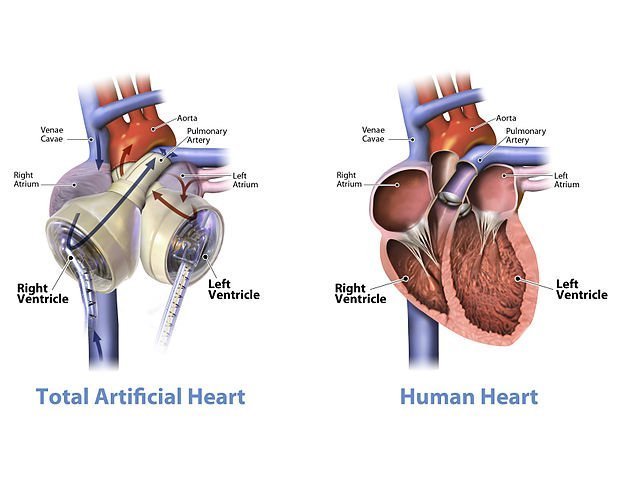 Artificial and Human hearts